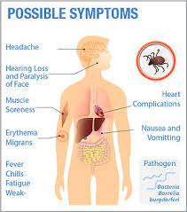 The Symptoms of Lyme Disease